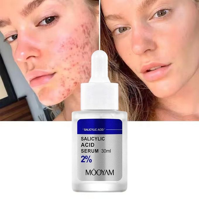 Sérum acide Salicylique de chez mooyam