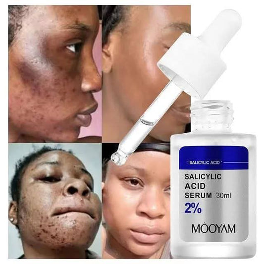 Sérum acide Salicylique de chez mooyam