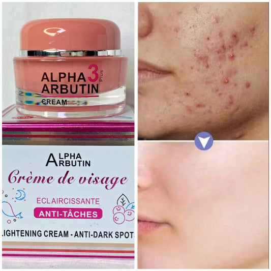 🧴 Alpha Arbutin 3+ | Crème Visage Éclaircissante & Anti-Taches